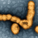 A strain of the H1N1 influenza virus, seen above. Image: National Institute of Allergy and Infectious Diseases